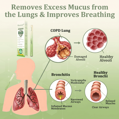 𝙊𝙛𝙛𝙞𝒄𝒊𝒂𝒍 𝑺𝒕𝒐𝒓𝒆✅𝐌𝐮𝐫𝐰𝒐𝒏® 𝐁𝐨𝐭𝐚𝐧𝐢𝐜𝐚𝐥 𝐌𝐮𝐥𝐥𝐞𝐢𝐧 𝐋𝐮𝐧𝐠 𝐂𝐥𝐞𝐚𝐧𝐬𝐞 𝐃𝐢𝐟𝐟𝐮𝐬𝐞𝐫🔥(👨‍⚕️Cough, Pharyngitis, shortness of breath, sputum, stuffy nose, bronchitis, bronchitis, allergy symptoms, lung discomfort)3❤️