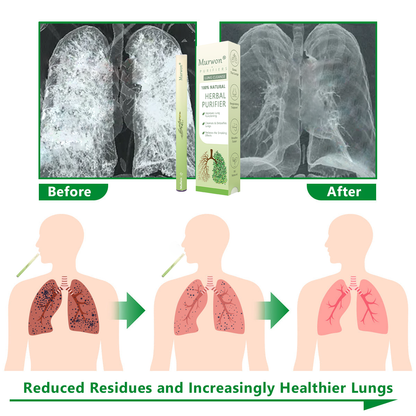 𝐈𝐫𝐞𝐥𝐚𝐧𝐝 𝐎𝐰𝐧𝐞𝐝 𝐚𝐧𝐝 𝐎𝐩𝐞𝐫𝐚𝐭𝐞𝐝✅ 𝐌𝐮𝐫𝐰𝒐𝒏® 𝐁𝐨𝐭𝐚𝐧𝐢𝐜𝐚𝐥 𝐌𝐮𝐥𝐥𝐞𝐢𝐧 𝐋𝐮𝐧𝐠 𝐂𝐥𝐞𝐚𝐧𝐬𝐞 𝐃𝐢𝐟𝐟𝐮𝐬𝐞𝐫(🫁Cough, Pharyngitis, shortness of breath, sputum, stuffy nose, bronchitis, bronchitis, allergy symptoms, lung discomfort)7